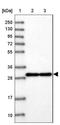 Killer Cell Lectin Like Receptor B1 antibody, NBP1-88130, Novus Biologicals, Western Blot image 