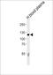 Complement C6 antibody, PA5-72500, Invitrogen Antibodies, Western Blot image 