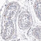 Spalt Like Transcription Factor 4 antibody, HPA015791, Atlas Antibodies, Immunohistochemistry paraffin image 