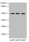 Casein Kinase 1 Gamma 1 antibody, LS-C675596, Lifespan Biosciences, Western Blot image 