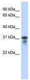 hMed6 antibody, TA335713, Origene, Western Blot image 