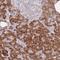 Zinc Finger Protein 510 antibody, HPA049139, Atlas Antibodies, Immunohistochemistry paraffin image 