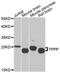 Tubulin Polymerization Promoting Protein antibody, A04389, Boster Biological Technology, Western Blot image 