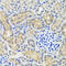ANTXR Cell Adhesion Molecule 2 antibody, 22-287, ProSci, Immunohistochemistry paraffin image 