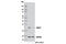 Ubiquitin Conjugating Enzyme E2 T antibody, 12992S, Cell Signaling Technology, Western Blot image 