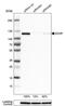Adenosine Deaminase RNA Specific antibody, PA5-52014, Invitrogen Antibodies, Western Blot image 