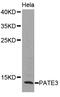 Prostate And Testis Expressed 3 antibody, MBS127711, MyBioSource, Western Blot image 