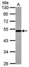 Diacylglycerol O-Acyltransferase 2 antibody, orb69729, Biorbyt, Western Blot image 