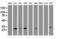 BCL10 Immune Signaling Adaptor antibody, M01616-2, Boster Biological Technology, Western Blot image 