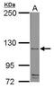 GP-Ib alpha antibody, GTX113202, GeneTex, Western Blot image 