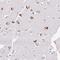 Replication Termination Factor 2 antibody, PA5-62891, Invitrogen Antibodies, Immunohistochemistry paraffin image 