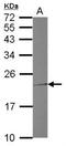 Troponin I1, Slow Skeletal Type antibody, NBP2-20733, Novus Biologicals, Western Blot image 