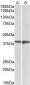Sphingosine-1-Phosphate Receptor 5 antibody, STJ71984, St John
