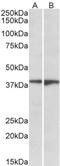 S1PR5 antibody, STJ71984, St John