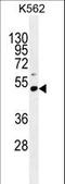 PRAME Family Member 10 antibody, LS-C162109, Lifespan Biosciences, Western Blot image 