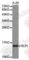 Secretory Leukocyte Peptidase Inhibitor antibody, A1897, ABclonal Technology, Western Blot image 