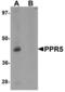 Proline Rich 5 antibody, LS-B7098, Lifespan Biosciences, Western Blot image 