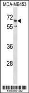 Cation channel sperm-associated protein 2 antibody, 60-254, ProSci, Western Blot image 