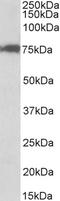 Cleavage Stimulation Factor Subunit 3 antibody, EB10070, Everest Biotech, Western Blot image 