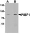 Progesterone Immunomodulatory Binding Factor 1 antibody, LS-B10082, Lifespan Biosciences, Western Blot image 