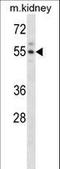 Activin A Receptor Type 2A antibody, LS-C164287, Lifespan Biosciences, Western Blot image 