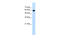 Cell Division Cycle 23 antibody, 29-826, ProSci, Western Blot image 