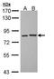 Protein Kinase C Theta antibody, PA5-34752, Invitrogen Antibodies, Western Blot image 