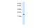 MYCL Proto-Oncogene, BHLH Transcription Factor antibody, PA5-41114, Invitrogen Antibodies, Western Blot image 