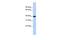 Phospholipid Phosphatase Related 5 antibody, GTX46678, GeneTex, Western Blot image 