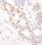 DEAD-Box Helicase 24 antibody, NB100-2226, Novus Biologicals, Immunohistochemistry paraffin image 