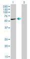 Immunoglobulin Heavy Constant Alpha 2 (A2m Marker) antibody, H00003494-D01P, Novus Biologicals, Western Blot image 