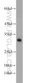 BCAS2 Pre-MRNA Processing Factor antibody, 10414-1-AP, Proteintech Group, Western Blot image 
