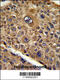 Transducer Of ERBB2, 1 antibody, 63-521, ProSci, Immunohistochemistry paraffin image 