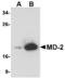 Lymphocyte Antigen 96 antibody, M02107, Boster Biological Technology, Western Blot image 