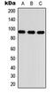 Transforming Growth Factor Beta Receptor 3 antibody, MBS8211844, MyBioSource, Western Blot image 