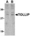 Toll Interacting Protein antibody, NBP1-76681, Novus Biologicals, Western Blot image 