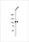 MER Proto-Oncogene, Tyrosine Kinase antibody, LS-C97474, Lifespan Biosciences, Western Blot image 