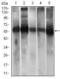 Aldehyde Dehydrogenase 2 Family Member antibody, GTX60727, GeneTex, Western Blot image 