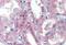 BRCA1/BRCA2-Containing Complex Subunit 3 antibody, MBS245430, MyBioSource, Immunohistochemistry paraffin image 