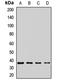 Melanocortin 3 Receptor antibody, LS-C667903, Lifespan Biosciences, Western Blot image 