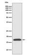 Peptidylprolyl Isomerase A antibody, M01308, Boster Biological Technology, Western Blot image 