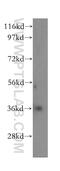 Carbonic Anhydrase 11 antibody, 15435-1-AP, Proteintech Group, Western Blot image 