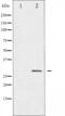 Heat Shock Protein Family B (Small) Member 1 antibody, abx010948, Abbexa, Western Blot image 