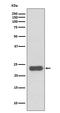 O-6-Methylguanine-DNA Methyltransferase antibody, M01012, Boster Biological Technology, Western Blot image 