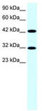 General Transcription Factor IIH Subunit 2 antibody, TA330121, Origene, Western Blot image 