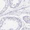Tryptase Delta 1 antibody, NBP2-31981, Novus Biologicals, Immunohistochemistry frozen image 