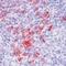 Syndecan 1 antibody, MA5-12400, Invitrogen Antibodies, Immunohistochemistry paraffin image 