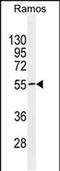 Testis Specific 10 Interacting Protein antibody, PA5-48194, Invitrogen Antibodies, Western Blot image 