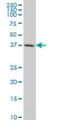 C-X-C Motif Chemokine Receptor 4 antibody, H00007852-M02, Novus Biologicals, Western Blot image 