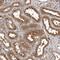 RWD Domain Containing 1 antibody, NBP1-80870, Novus Biologicals, Immunohistochemistry paraffin image 